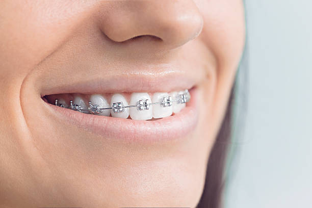 Best Wisdom Tooth Removal  in Vadnais Heights, MN